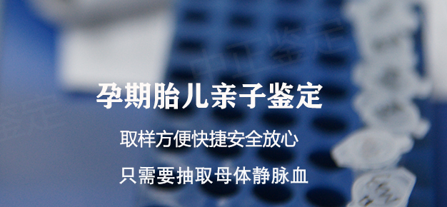 阿坝怀孕亲子鉴定正规中心在哪,阿坝孕期亲子鉴定结果准不准确