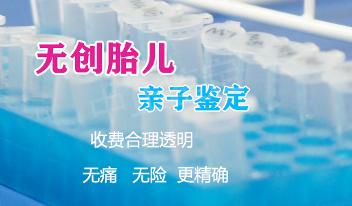 阿坝胎儿亲子鉴定哪里做,阿坝孕期亲子鉴定出结果时间